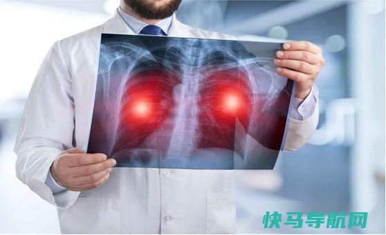 如何预防肺癌 第3张